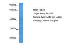 DUSP2 Rabbit anti-Human, Polyclonal, Novus Biologicals 0.1 mL | Buy Online | Novus Biologicals | Fisher Scientific